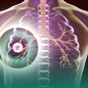 Hepatitis B